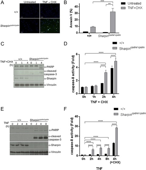 Sharpin prevents skin inflammation by inhibiting TNFR1-induced ...