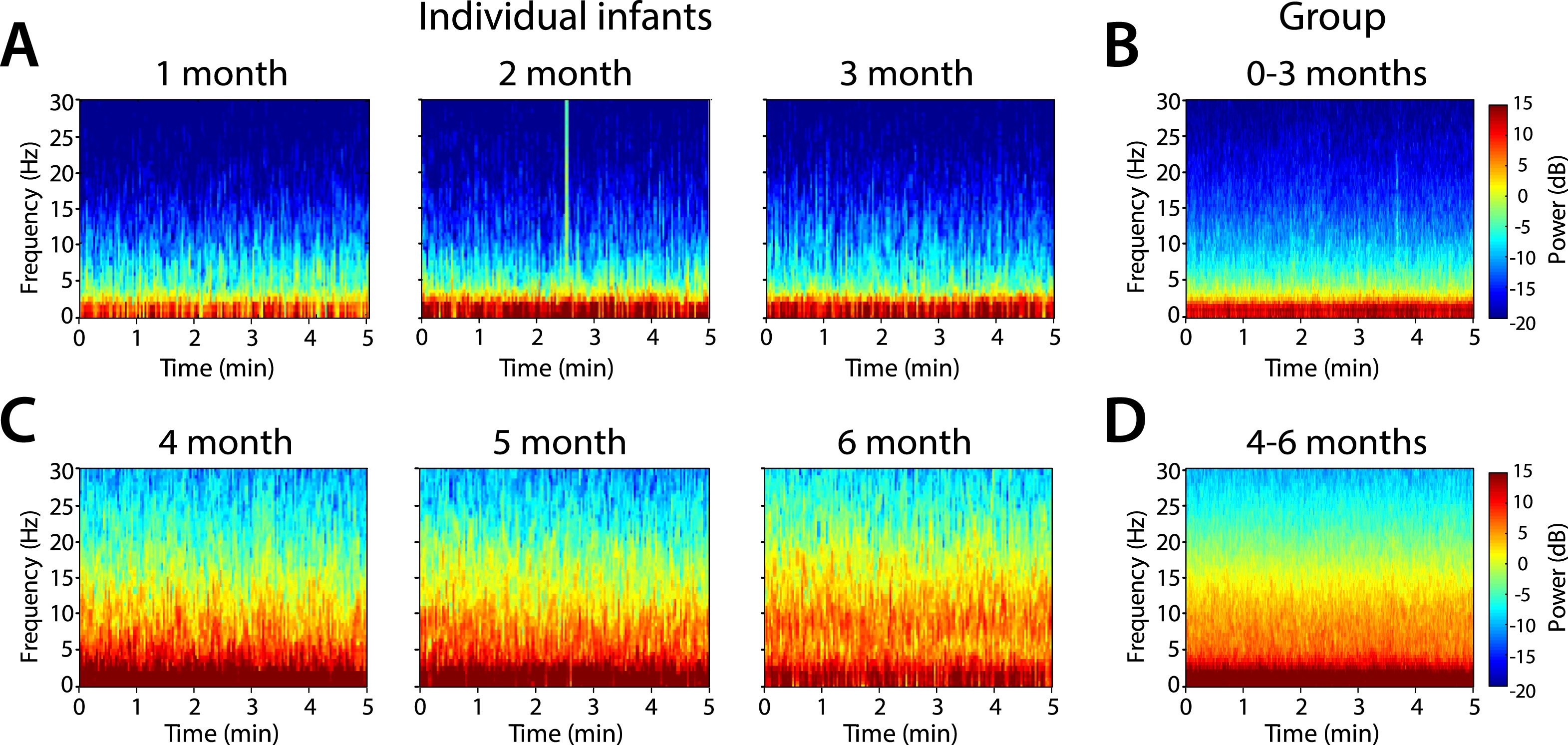 Age-dependent electroencephalogram (EEG) patterns during sevoflurane ...